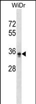 1 - PIGL Antibody (N-term) AP16850a