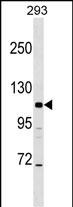 1 - AP3B2 Antibody (N-term) AP16877a
