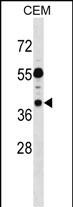 1 - TSSC1 Antibody (C-term) AP16907b