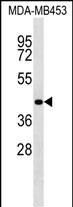 1 - RBM4 Antibody (C-term) AP16990b