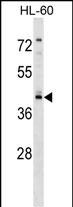 1 - RGS11 Antibody (Center) AP17022c