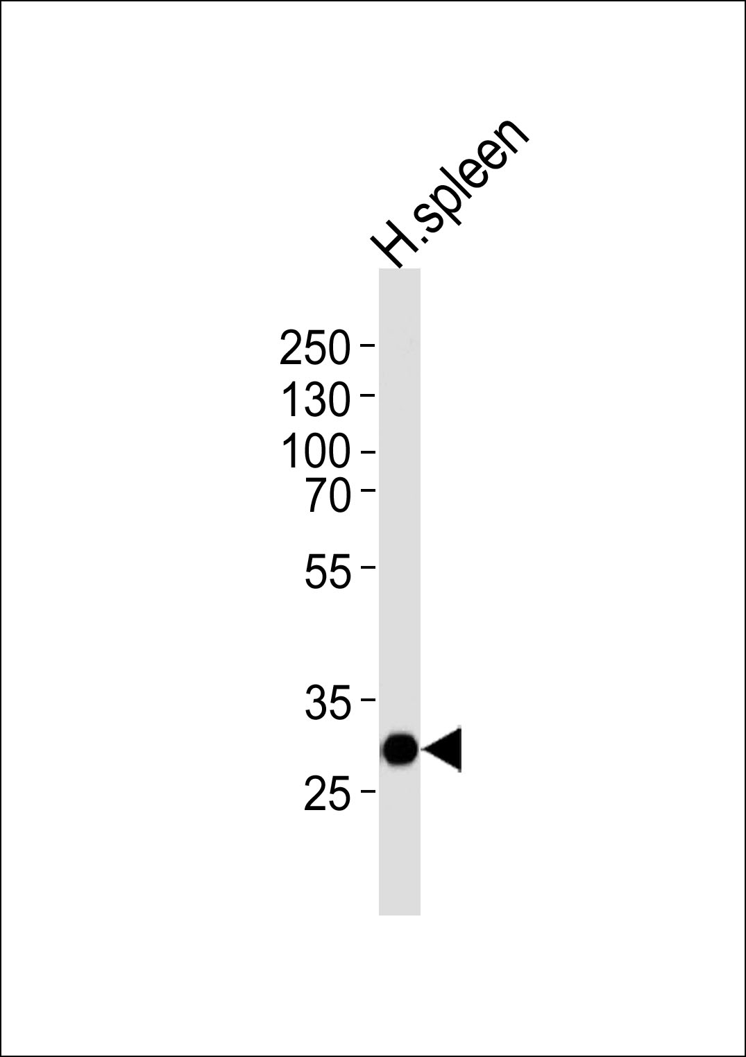 1 - SAP30 Antibody (C-term) AP17053b