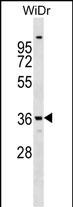 1 - ANXA9 Antibody (Center) AP17062c