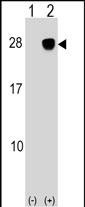 1 - ULBP2 Antibody (Center) AP17088C