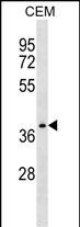 1 - NDRG4 Antibody (Center) AP17090c