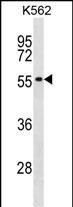 1 - POLR1E Antibody (Center) AP17099c