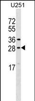 1 - OSTF1 Antibody (N-term) AP17103a