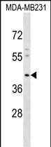 1 - KCNJ15 Antibody (C-term) AP17113B