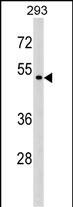 1 - P2RX6 Antibody (Center) AP17114c