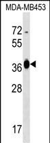 1 - GFOD2 Antibody (N-term) AP17123a