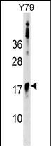 1 - BCL7B Antibody (C-term) AP17168b