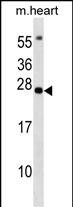 1 - BCL7B Antibody (C-term) AP17168b