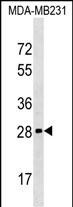 1 - H1FOO Antibody (Center) AP17183c