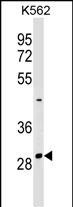 1 - NRIP2 Antibody (Center) AP17224C