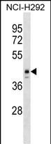 1 - ESX1 Antibody (N-term) AP17259a