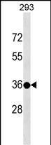 1 - TSPY3 Antibody (C-term) AP17280b