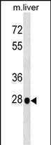 1 - Mouse Hoxb5 Antibody (N-term) AP17307a