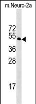 1 - Mouse Stk39 Antibody (C-term) AP17317b