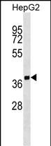 1 - SCAMP2 Antibody (Center) AP17324c