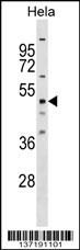 1 - RBM23 Antibody (Center) AP17329C