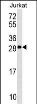 1 - ANP32C Antibody (Center) AP17348c