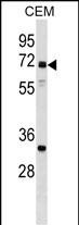 1 - NPLOC4 Antibody (C-term) AP17356b