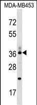 1 - CD68/CD68 (kpi) Antibody (Center) AP17393C