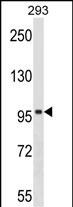 1 - SPIRE1 Antibody (C-term) AP17465b