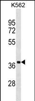 1 - UBLCP1 Antibody (C-term) AP17480b