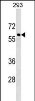 1 - CACNB3 Antibody (C-term) AP17493b