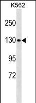 1 - CHERP Antibody (C-term) AP17516b