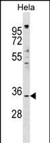1 - IMPACT Antibody (N-term) AP17553a