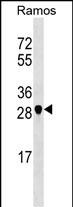 1 - NOSIP Antibody (N-term) AP17578a