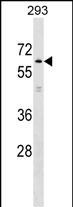 1 - KLHL2 Antibody (N-term) AP17585a