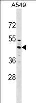1 - ZC3H10 Antibody (N-term) AP17613a