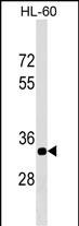 1 - ERAL1 Antibody (Center) AP17620c