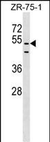 1 - PDZD3 Antibody (Center) AP17639c