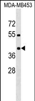 1 - PRRT2 Antibody (Center) AP17642c