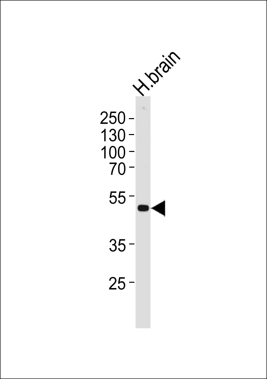 1 - KCNJ12 Antibody (C-term) AP17654b