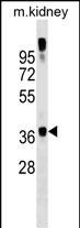 1 - GTF2A1 Antibody (C-term) AP17659b