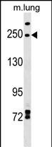 1 - INF2 Antibody (Center) AP17660c