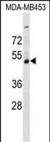 1 - SERPINI2 Antibody (C-term) AP17666b