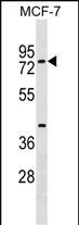 1 - TOX4 Antibody (N-term) AP17670A
