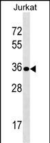1 - UPK3B Antibody (Center) AP17679c