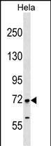 1 - FIGNL1 Antibody (N-term) AP17687a