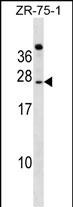 1 - IGSF6 Antibody (Center) AP17688c