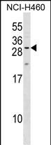 1 - MPZL2 Antibody (Center) AP17697c