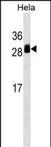 1 - TMED1 Antibody (Center) AP17714c