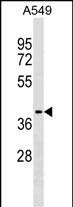 1 - ZCCHC12 Antibody (C-term) AP17722b