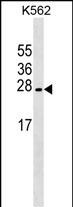 1 - LZIC Antibody (Center) AP17735c